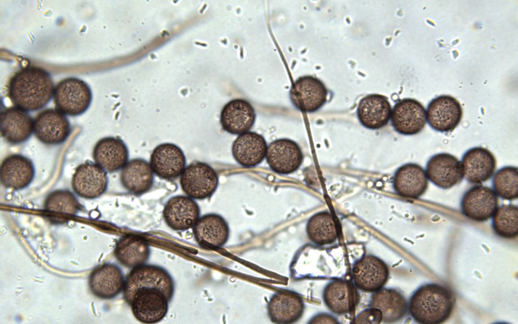 Diderma montanum (?)